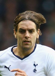 Woodgate predicts shock scalp