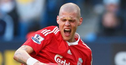 Martin Skrtel Liverpool injury v Manchester City