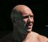 Fitz: Kiwis no pushovers