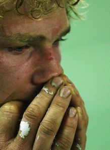 Rennie out for the season