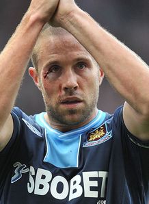 Upson shrugs off Sullivan slur