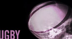 Tackle Our New Rugby Brain Quiz