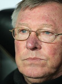 Fergie worried by bugs