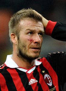 Milan invite Beckham back