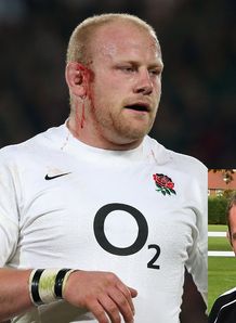 Dan Cole with blood from ear Dan Cole with blood from ear
