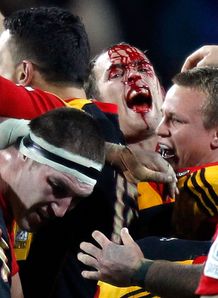 Chiefs back Andrew Horrell bloodied Chiefs back Andrew Horrell bloodied