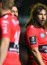 Italy prop out after 'dog bite'