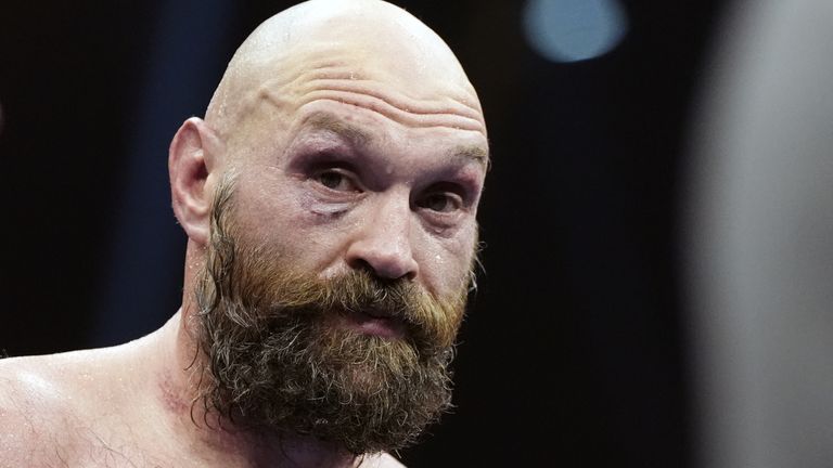 Tyson Fury