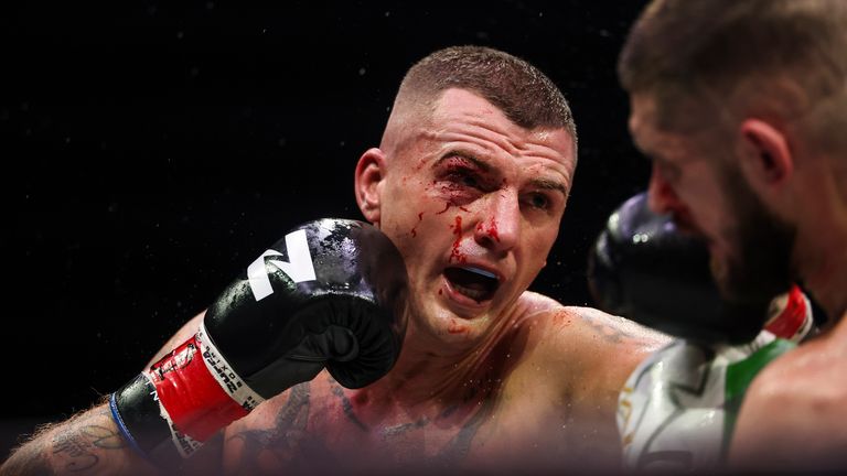 Coyle picked up a cut early in the fight (Photo: Ed Mulholland/Zuffa Boxing)