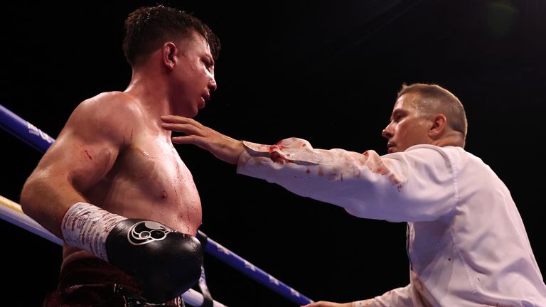 Pierce O'Leary is waved off by the referee and ends the fight against Mark Chamberlain